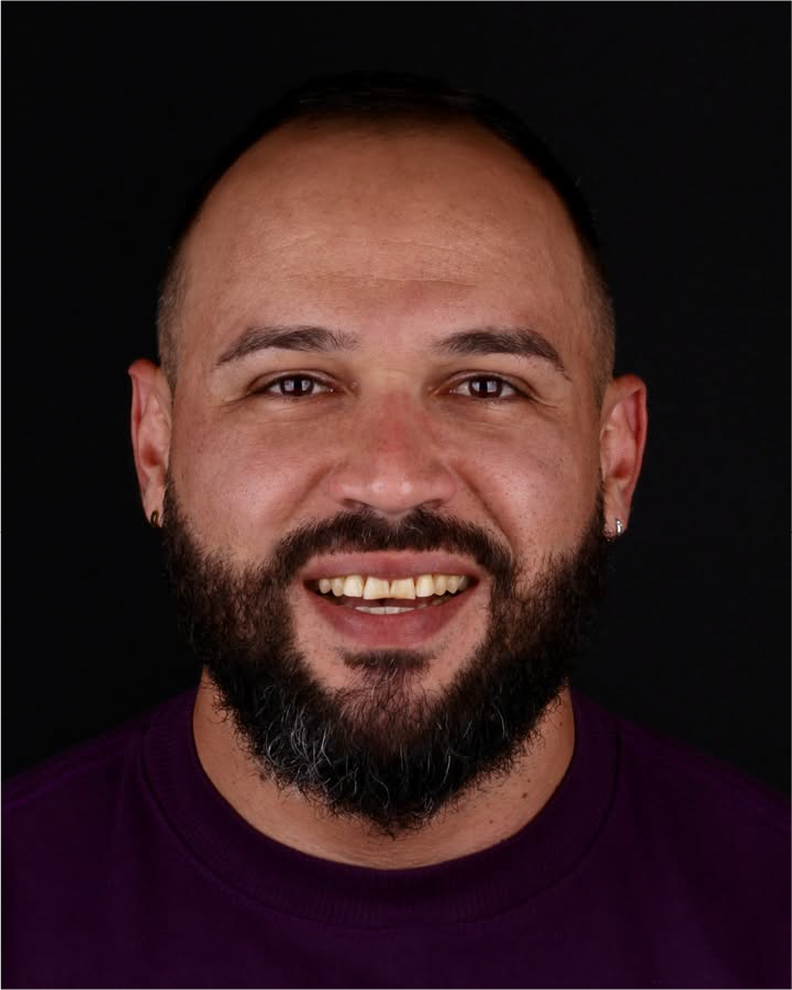 Sorriso antes do tratamento odontológico