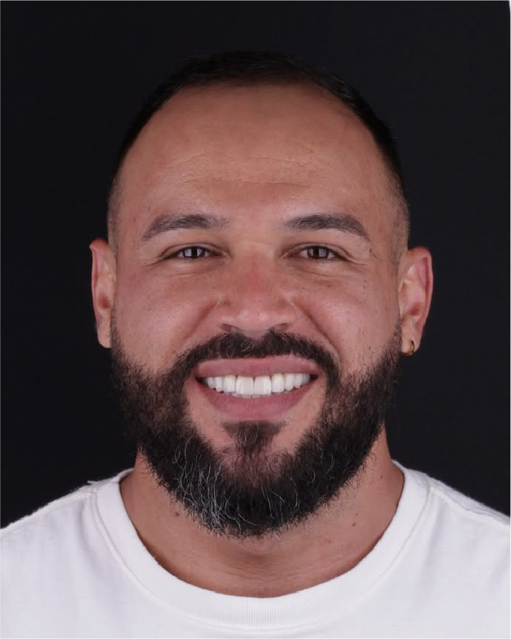 Sorriso depois do tratamento odontológico