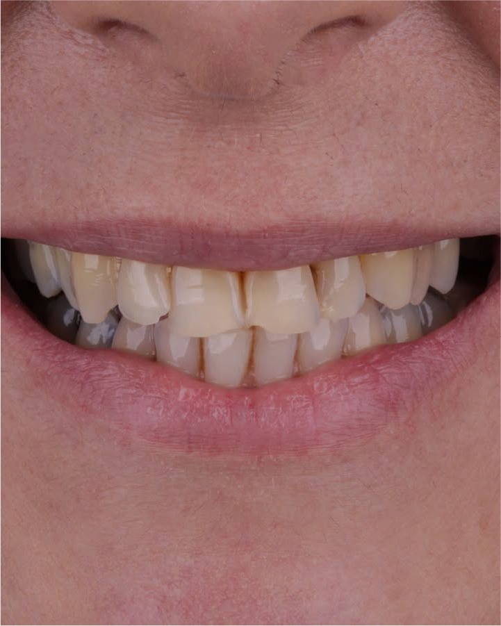 Sorriso antes do tratamento odontológico
