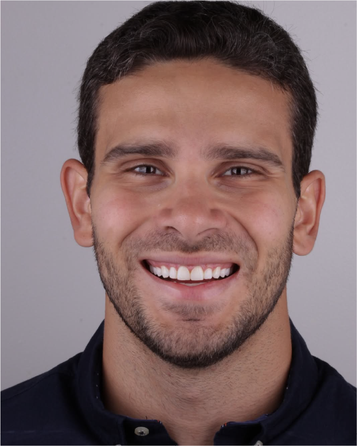 Sorriso antes do tratamento odontológico
