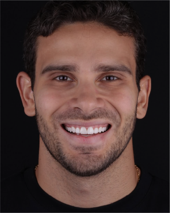Sorriso depois do tratamento odontológico