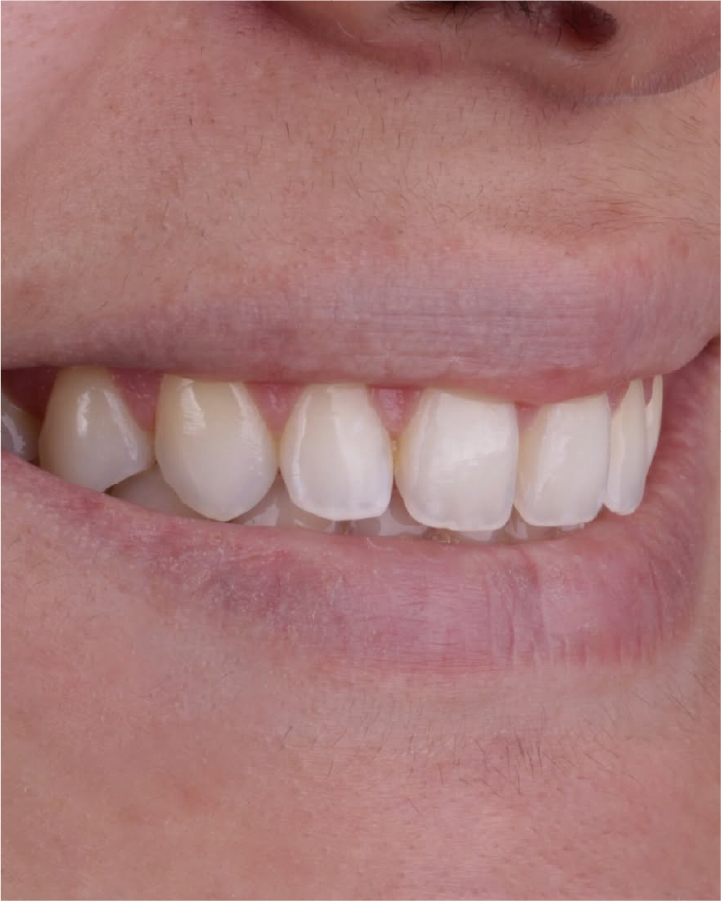 Sorriso antes do tratamento odontológico